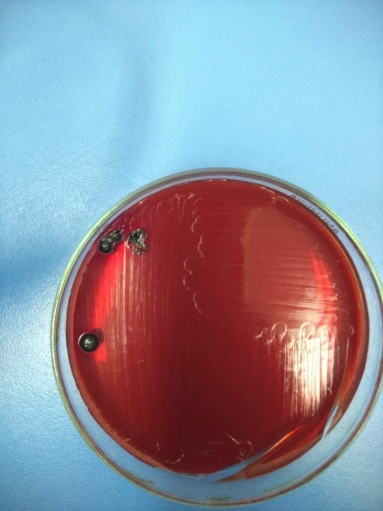 Black Color Colonies on XLD agar showing the presence of Salmonella